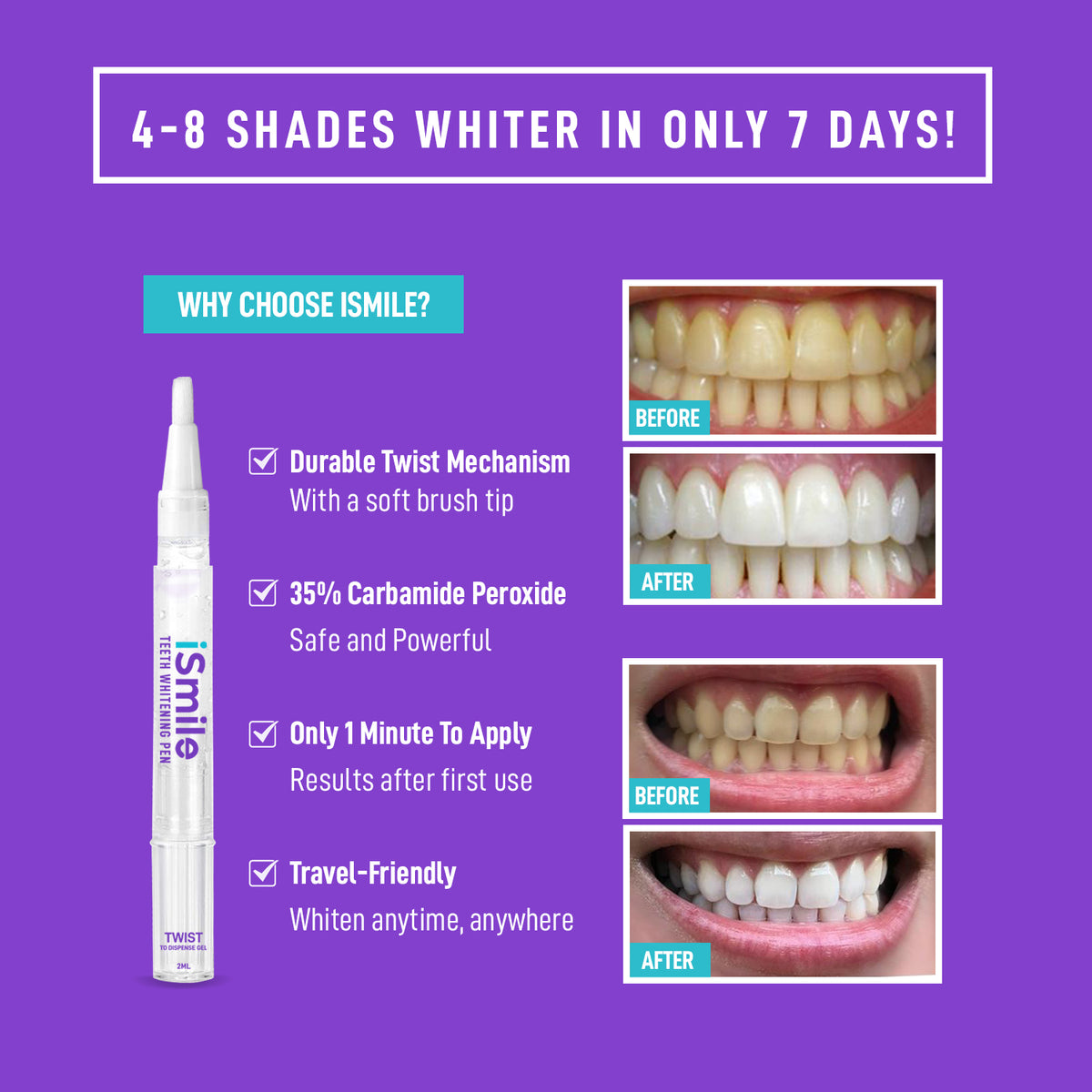 iSmile Teeth Whitening Pen – iSmile Whitening - Main Image