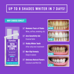 iSmile Teeth Whitening Strips